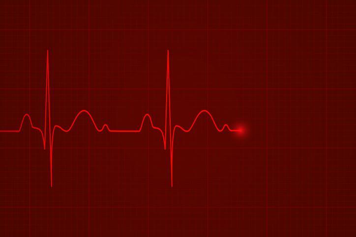 ekg